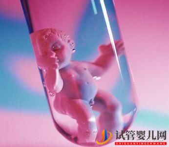 试管婴儿怎么做的全过程_什么是龙虎彩票官网首页
(图1)
