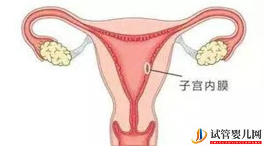 做俄罗斯试管婴儿需要调理内膜吗？调内膜一般要多少天(图1)