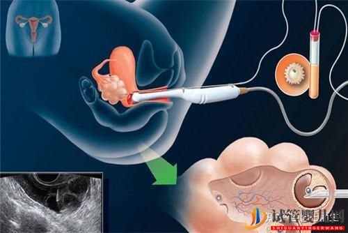 龙虎彩票官网首页
可以查出哪些疾病(图2) 龙虎彩票官网首页
可以查出哪些疾病(图2)