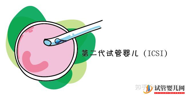 什么是三代试管婴儿龙虎彩票官网首页
成功率高(图3)