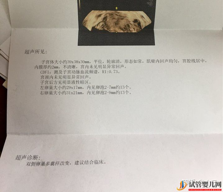 国内龙虎彩票官网首页
到底能不能选男女(图1)