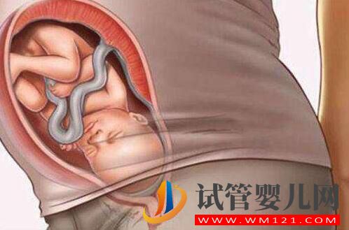 做试管婴儿的全部流程和费用 全部做完要多长时间(图2) 做试管婴儿的全部流程和费用 全部做完要多长时间(图2)