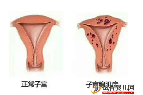 上海徐汇区试管婴儿哪里做，上海哪能做试管婴儿 (图1)
