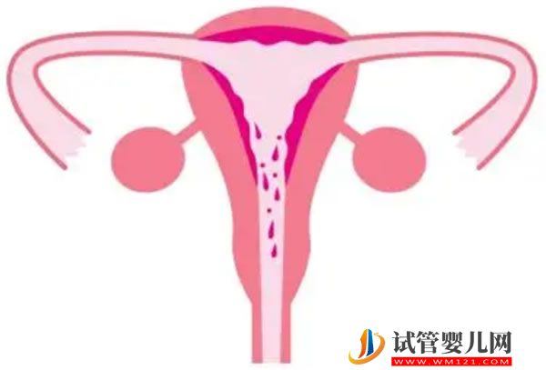 成都市第五人民医院试管婴儿怎么样，助孕成功率数据公开(图1)